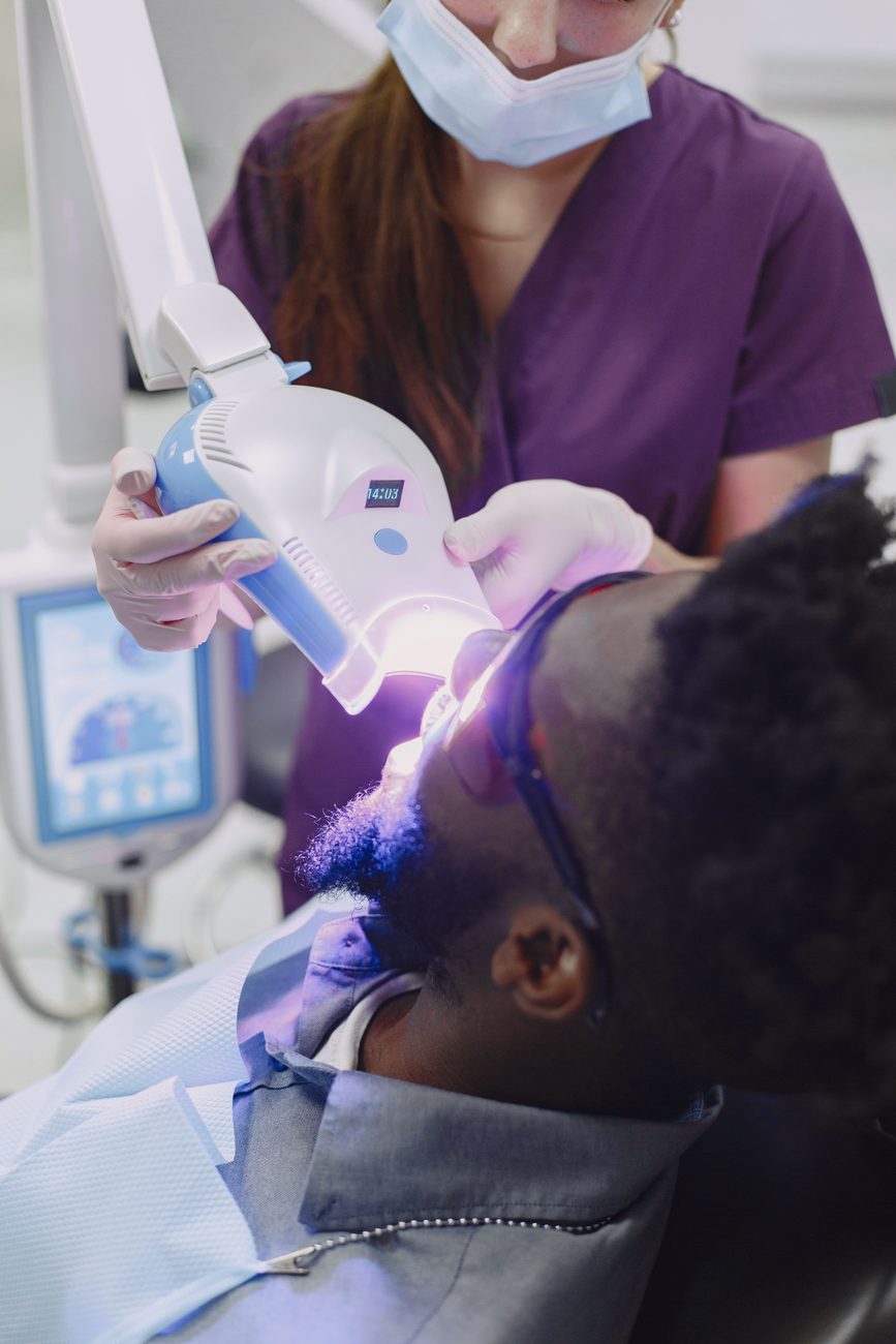 Professional bleaching