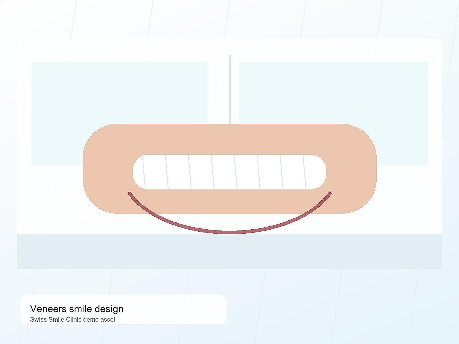 Veneer smile design
